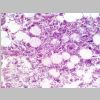 Medula osea HE 03.jpg